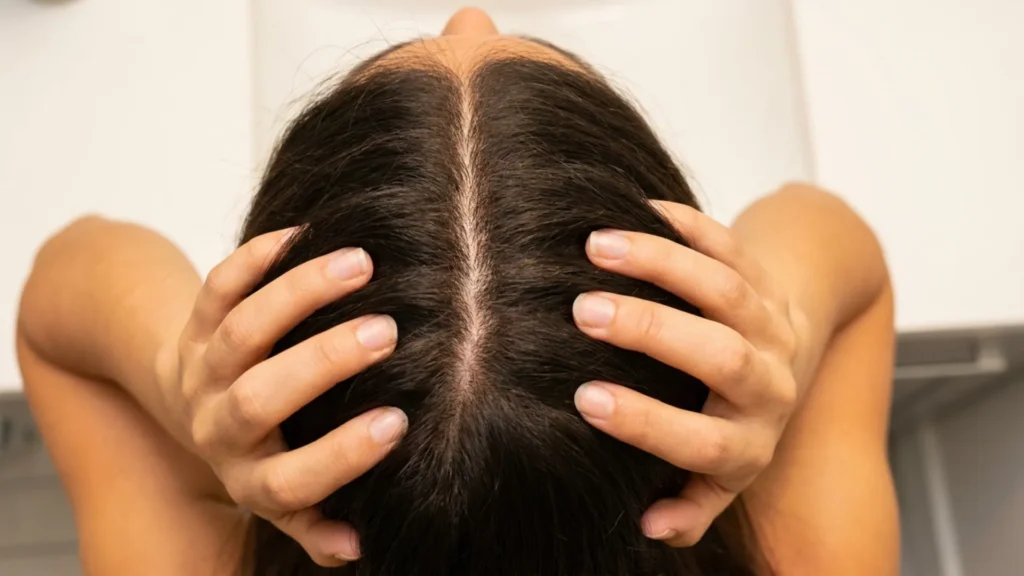 Overhead close-up of fingertips performing a gentle scalp massage through natural dark hair